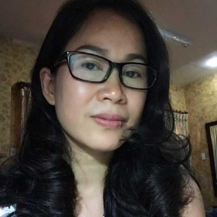 Cắt mí mắt