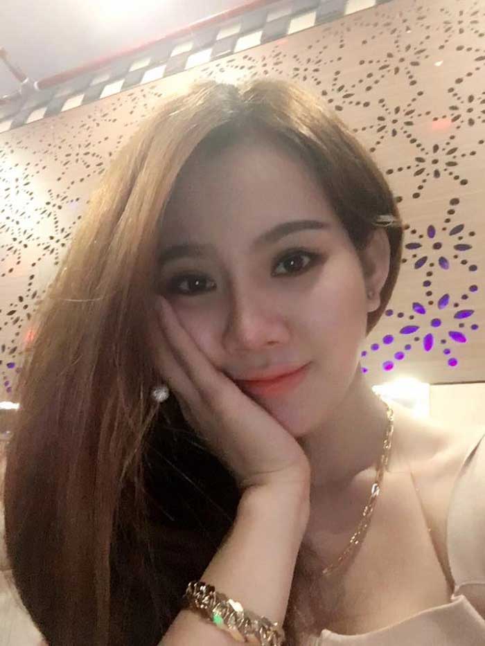 Nâng mũi bọc sụn