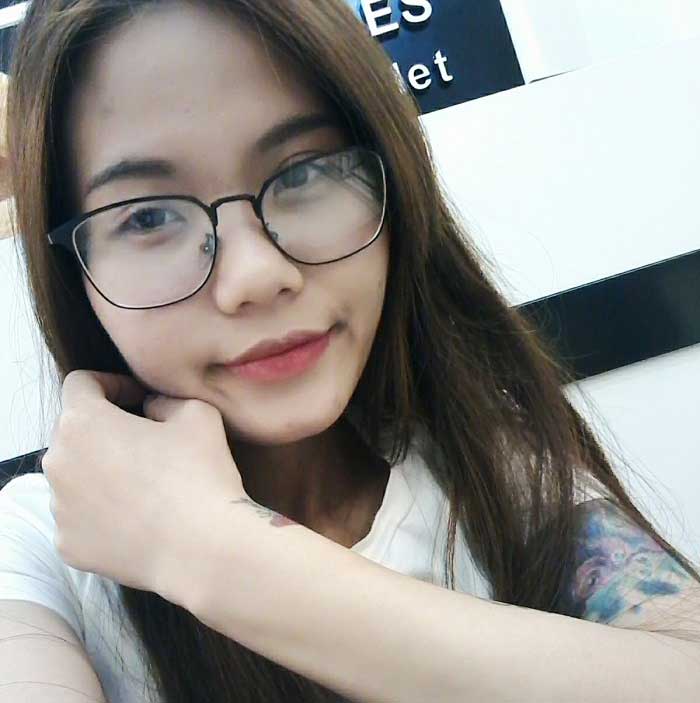 Nâng mũi bọc sụn