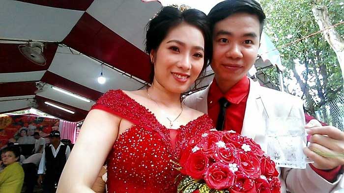 Nâng mũi bọc sụn