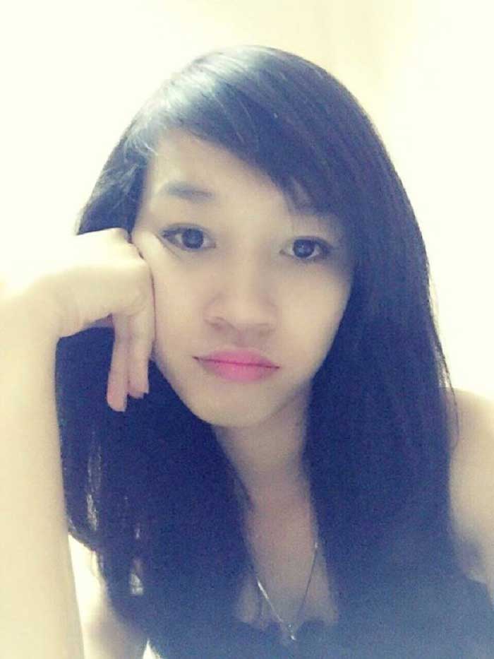 Nâng mũi bọc sụn