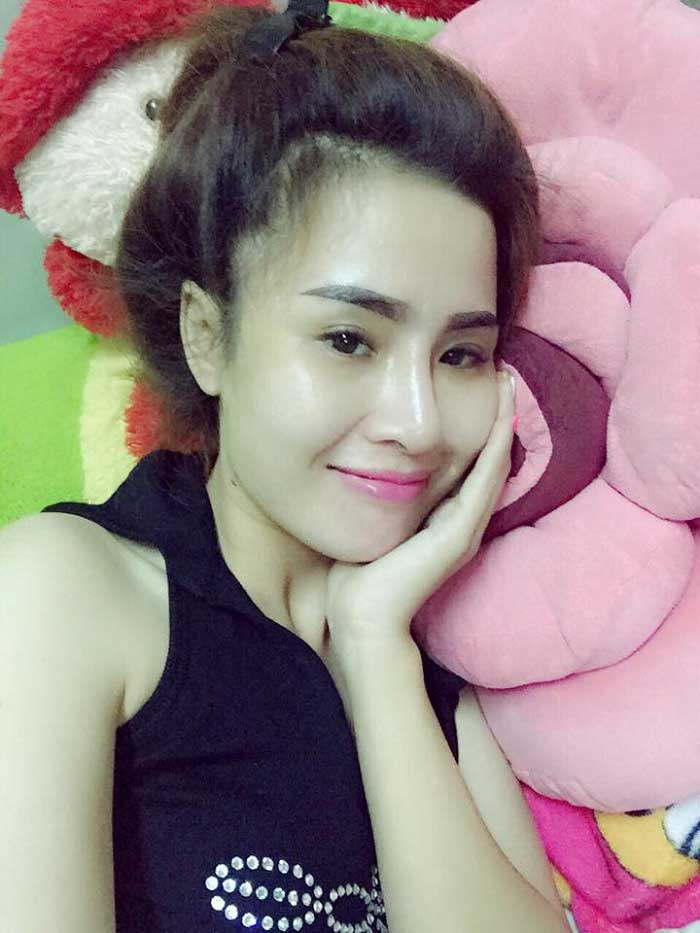 Nâng mũi Hàn Quốc