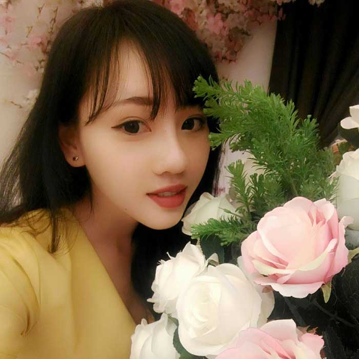 Nâng mũi bọc sụn