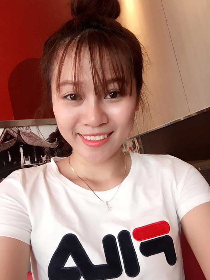 Nâng mũi bọc sụn