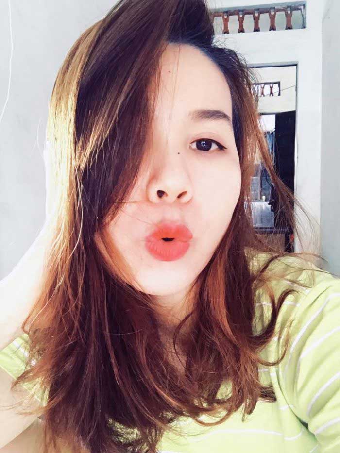 Cắt mí mắt