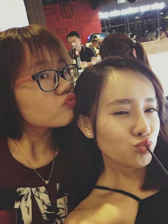 Nâng mũi bọc sụn