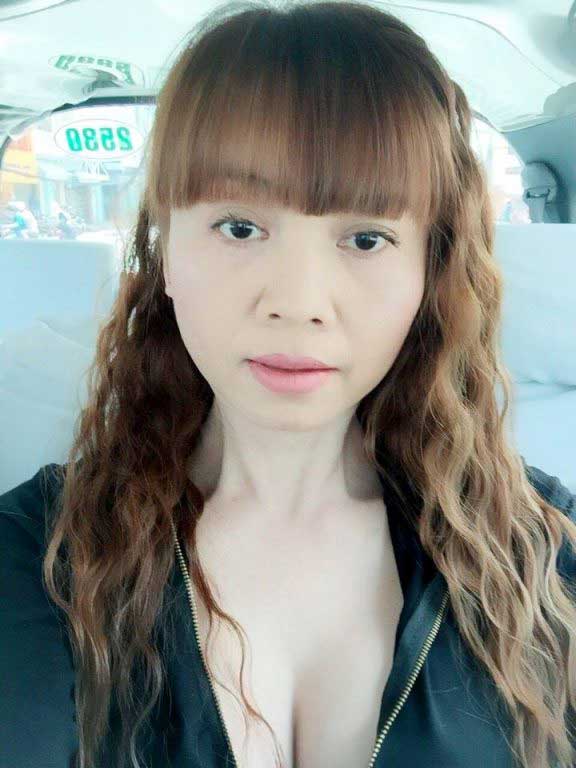Nâng ngực nội soi