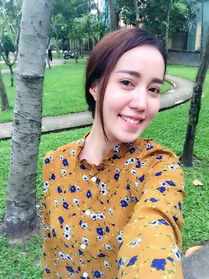 Cắt mí mắt