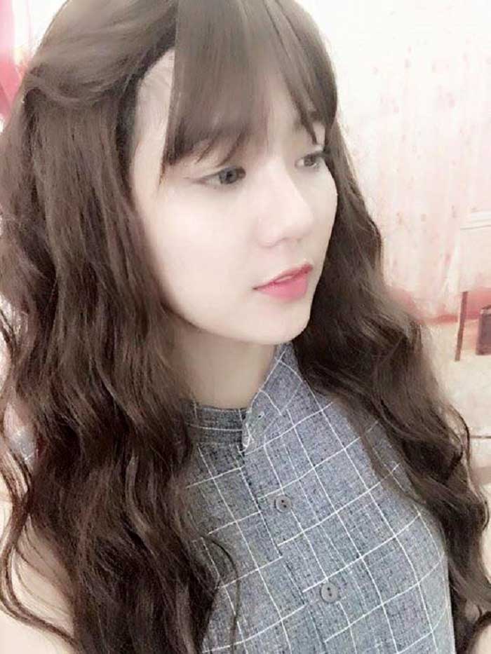 Nâng mũi bọc sụn