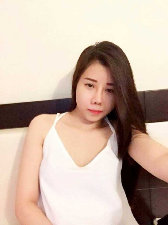 Nâng mũi bọc sụn