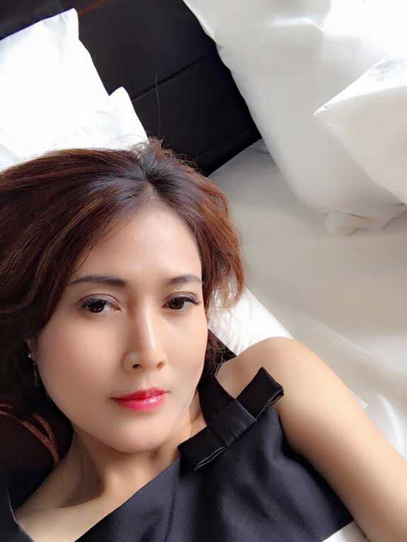 Căng da mặt Căng da mặt