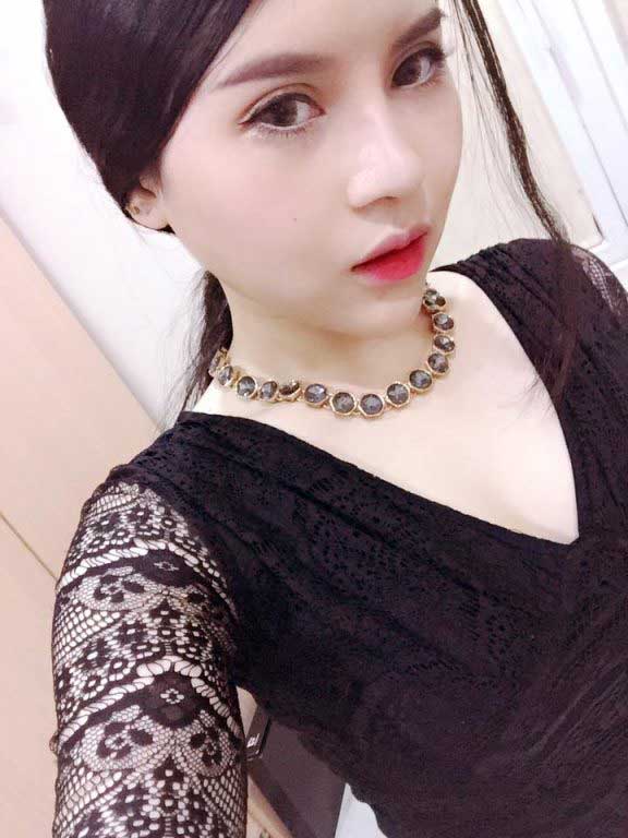 Nâng mũi S Line