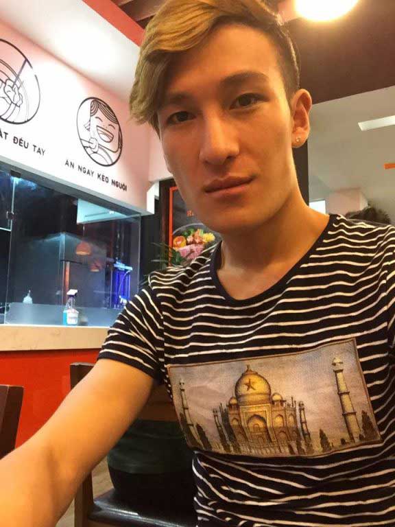 Làm đầy môi