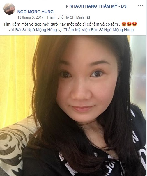 Mở rộng góc mắt