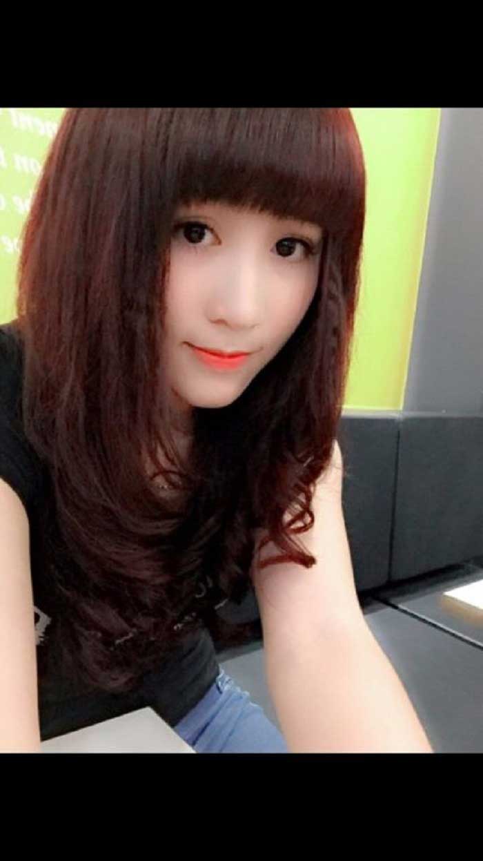 Nâng mũi bọc sụn