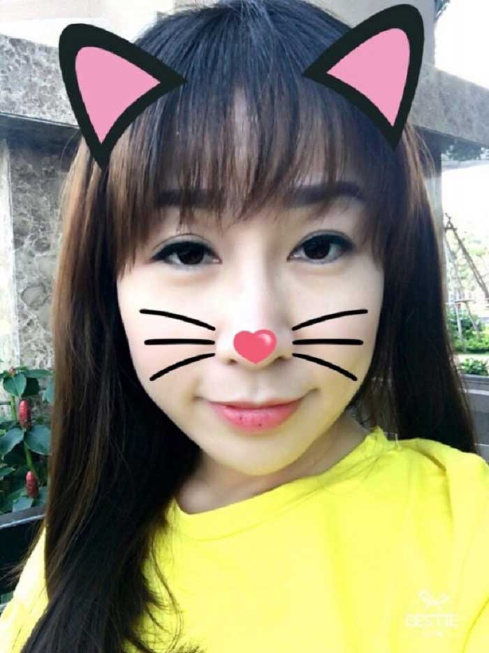Cắt mí mắt