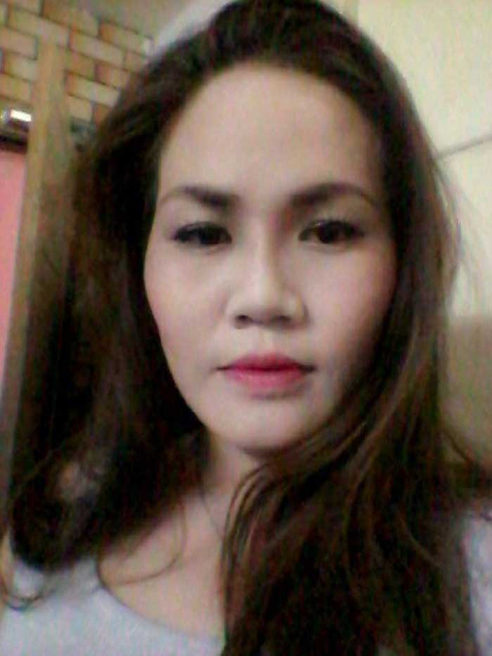 Nâng mũi bọc sụn