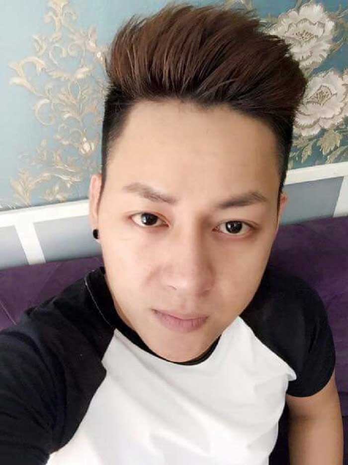 Nâng mũi bọc sụn