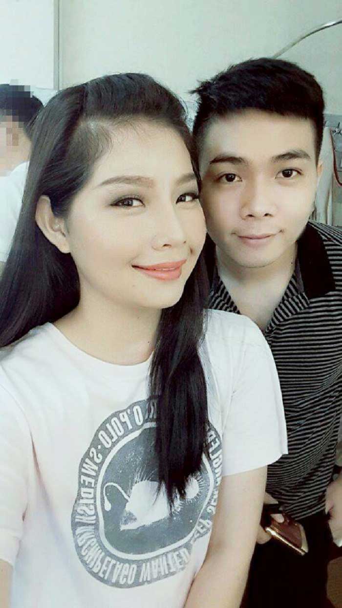 Nâng mũi bọc sụn