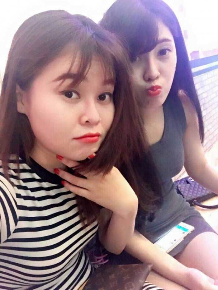 Nâng mũi bọc sụn