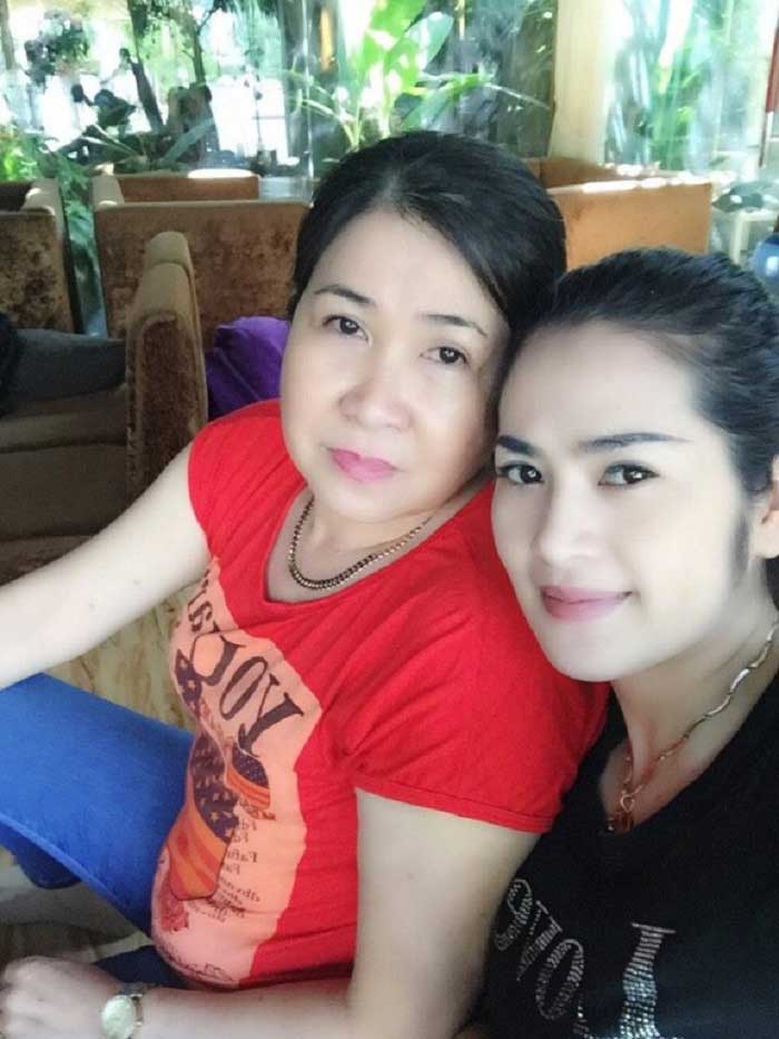 Cắt mí mắt