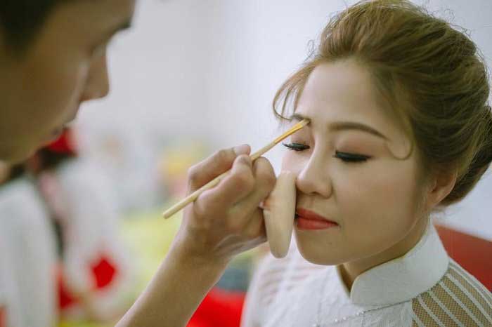 Nâng mũi bọc sụn