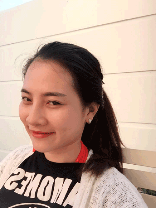 Nâng mũi bọc sụn