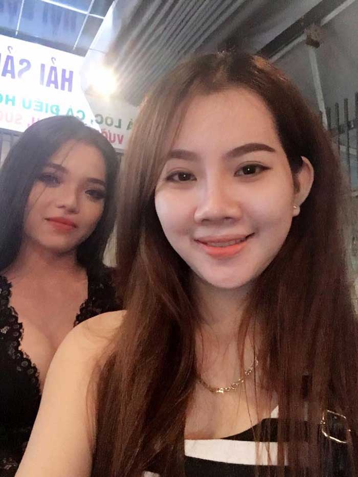 Bấm mí Hàn Quốc