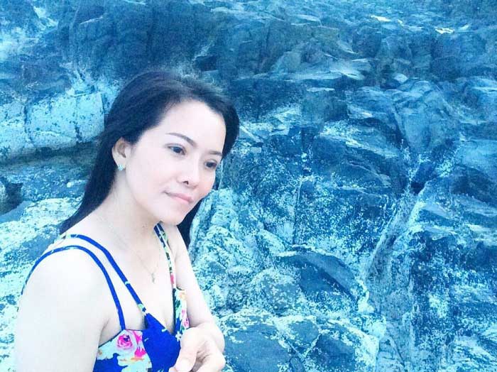 Nâng mũi bọc sụn Nâng mũi bọc sụn