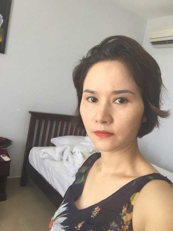Độn cằm