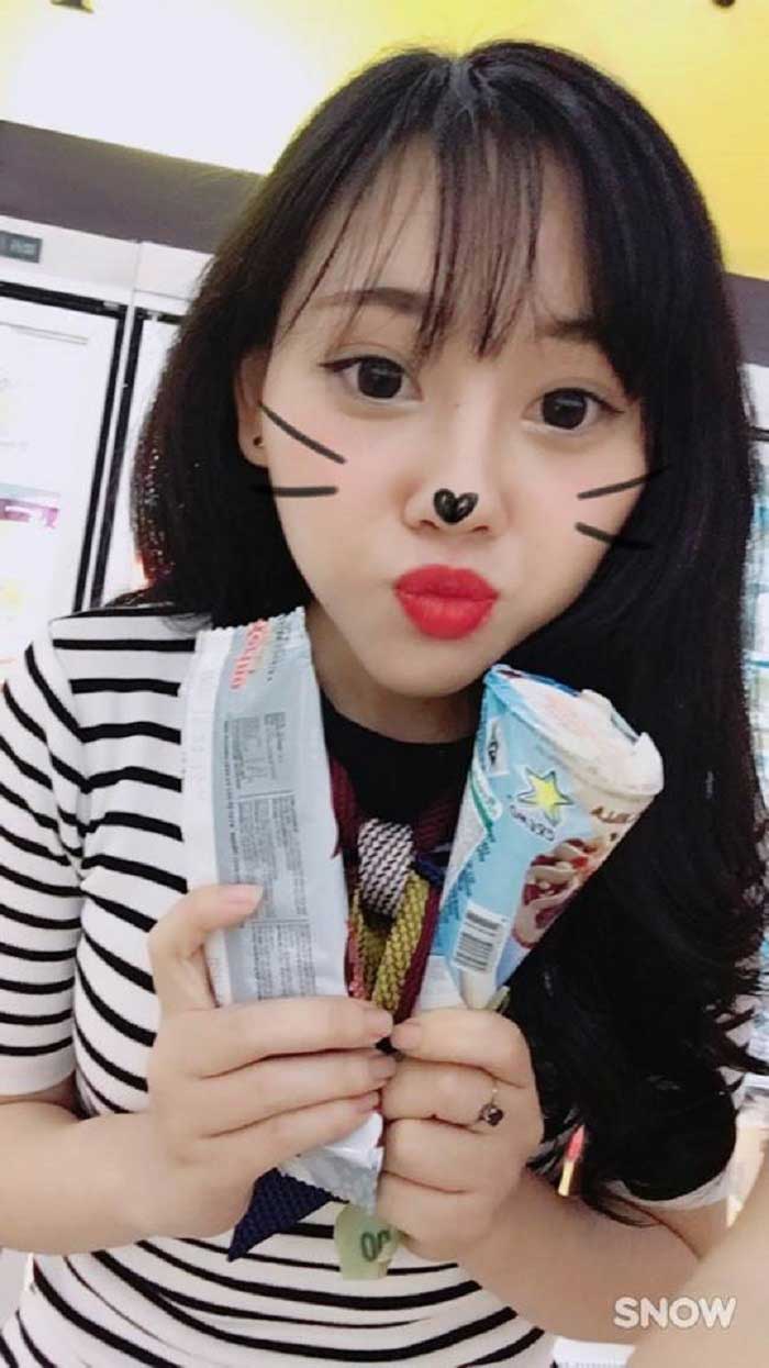 Nâng mũi bọc sụn