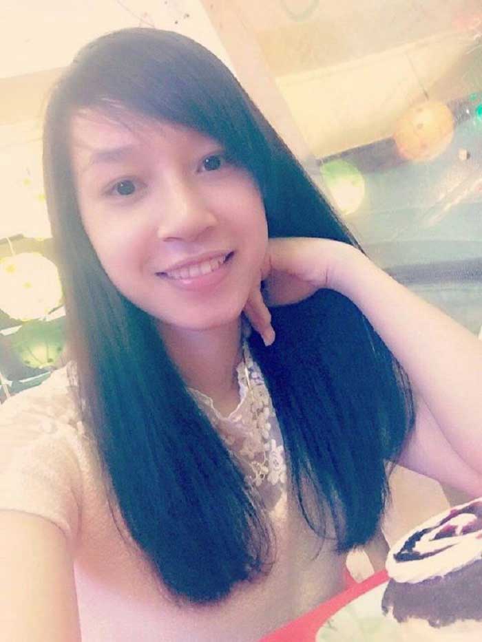 Nâng mũi bọc sụn