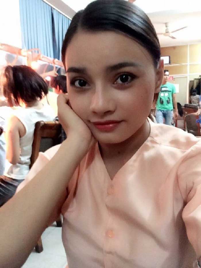 Nâng mũi bọc sụn