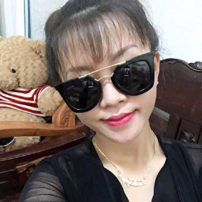 Nâng mũi bọc sụn