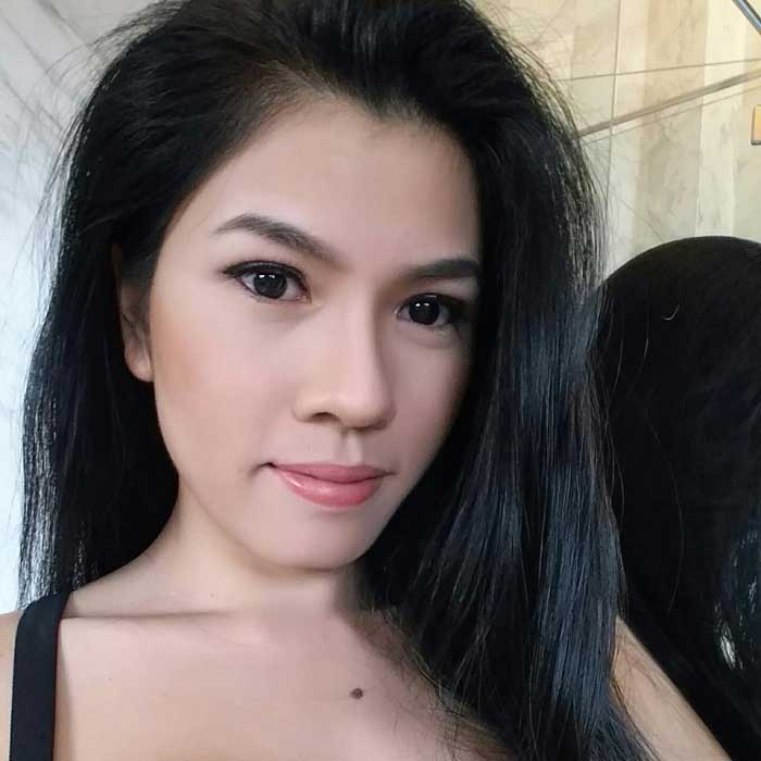 Lấy mỡ má
