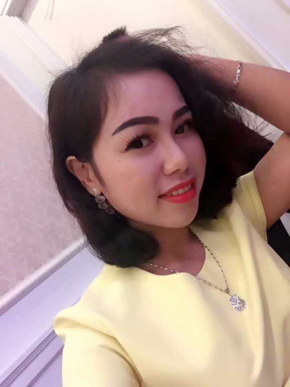 Độn cằm