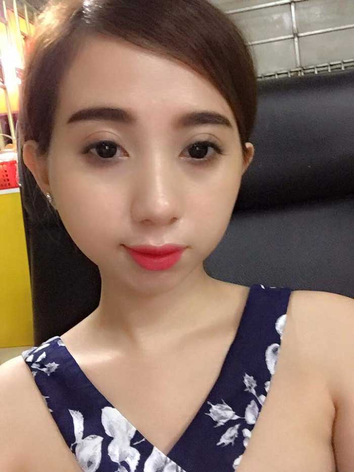 Bấm mí Hàn Quốc