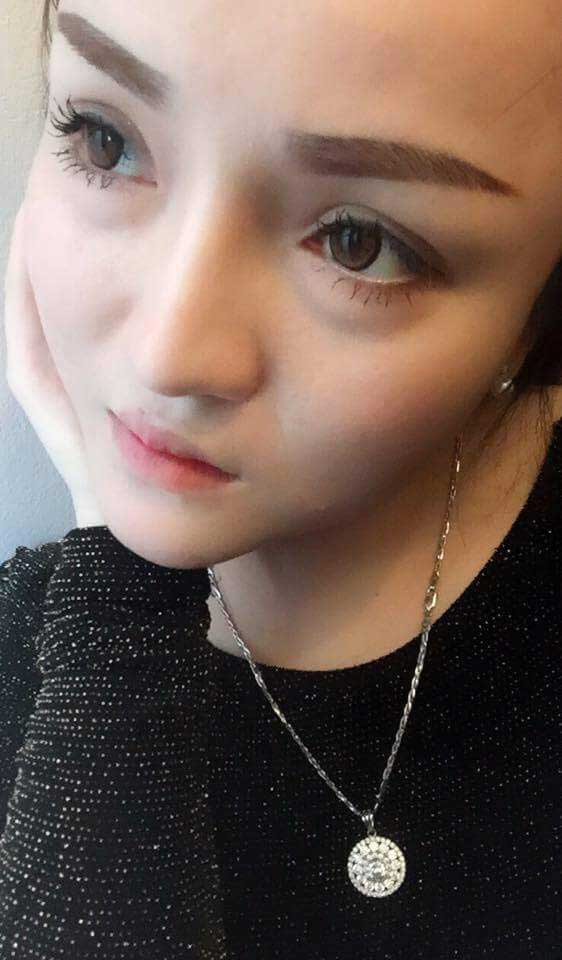 Độn cằm