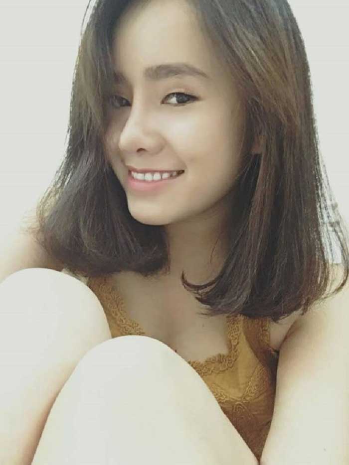 Nâng mũi bọc sụn