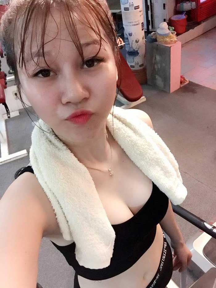 Nâng mũi bọc sụn
