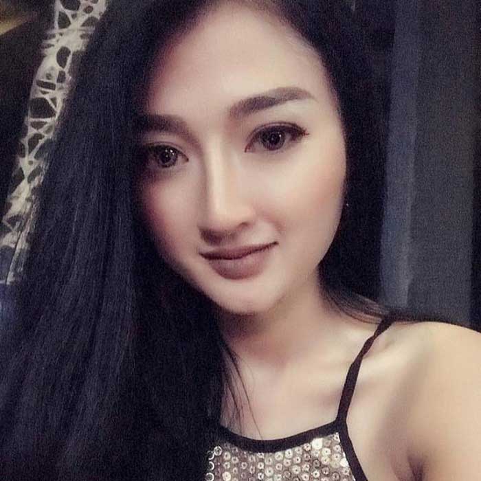 Gọt cằm
