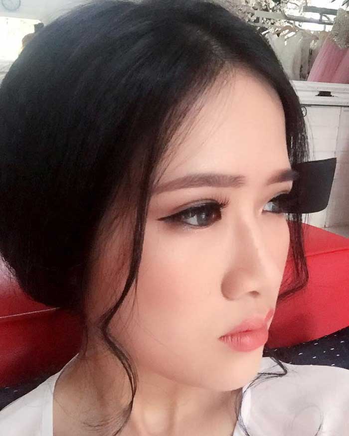 Bấm mí Hàn Quốc