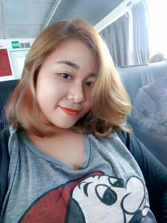Cắt mí mắt