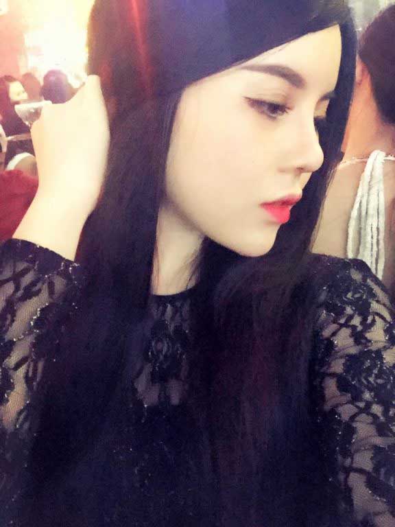 Nâng mũi S Line
