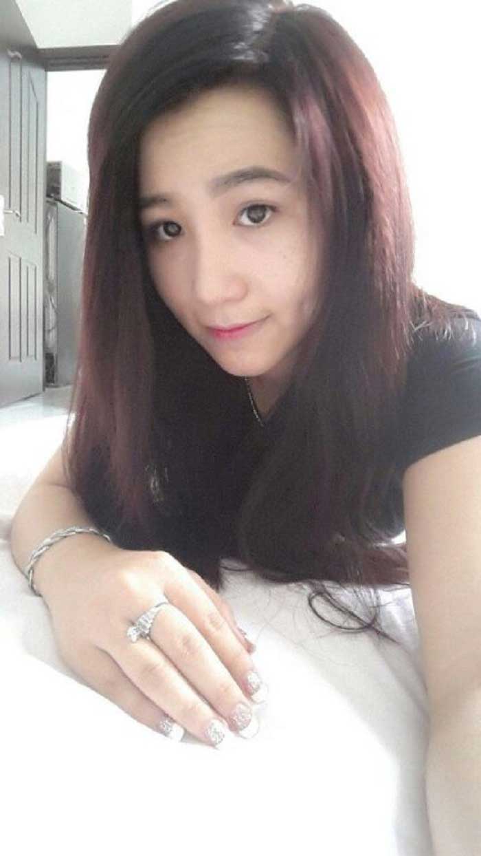 Nâng mũi bọc sụn