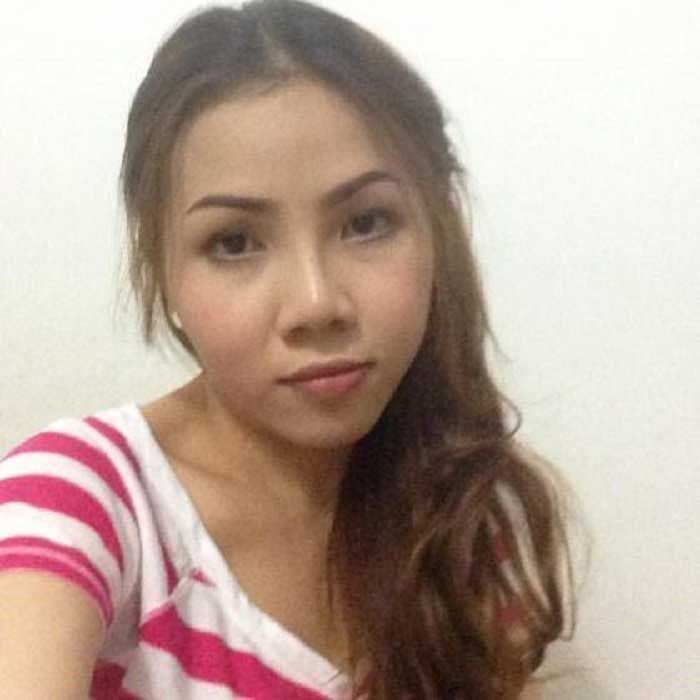 Nâng mũi Hàn Quốc