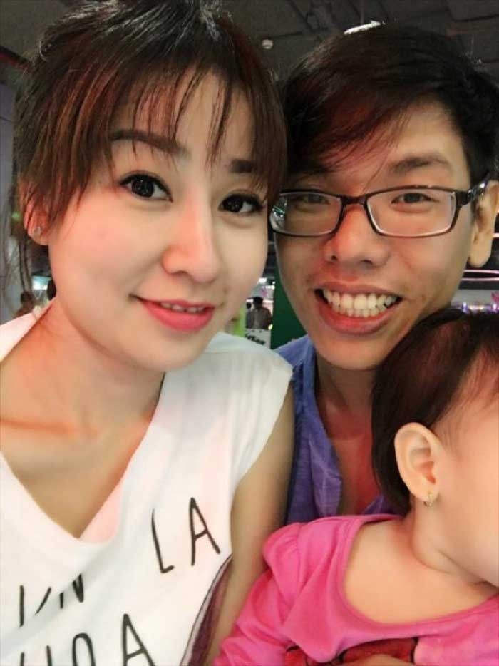Cắt mí mắt