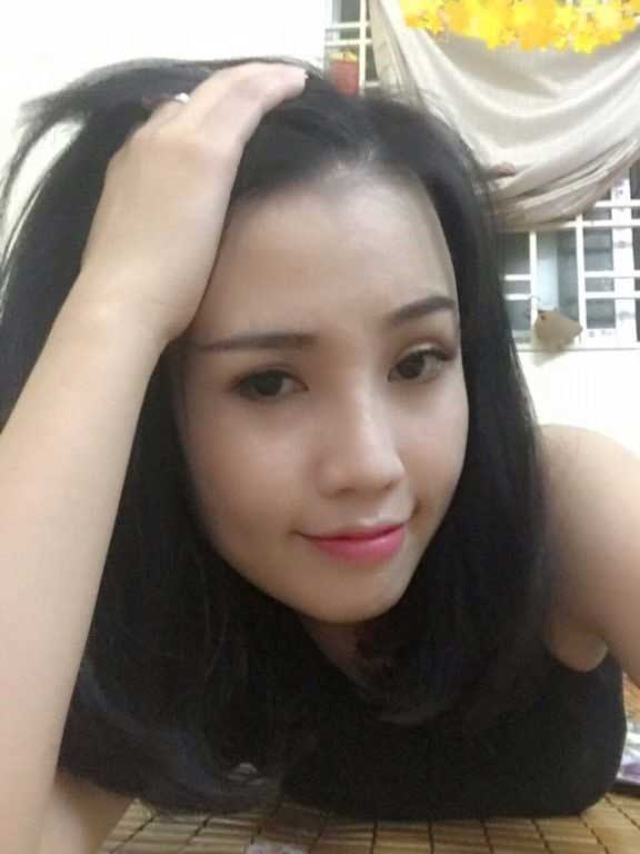 Bấm mí Hàn Quốc