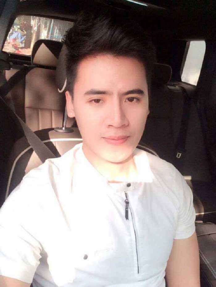 Nâng mũi bọc sụn