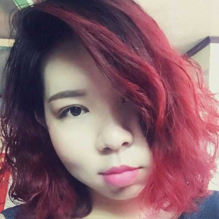 Cắt mí mắt